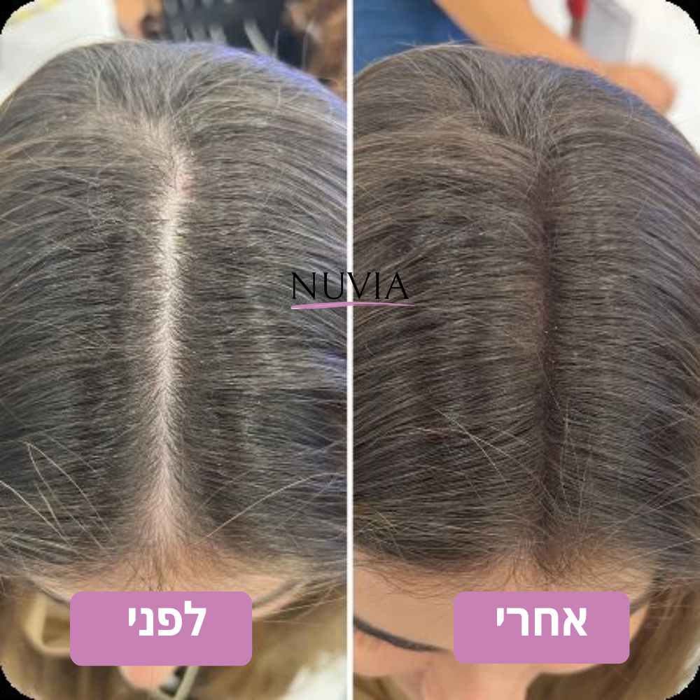 "ערכת הטיפוח שהצילה לי את היום יום"