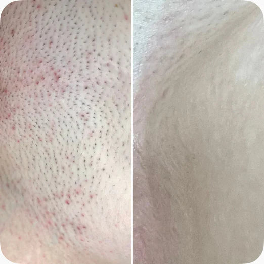 NUVIA Glow