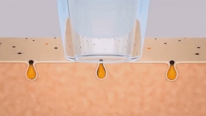 מכשיר להסרת השחורים